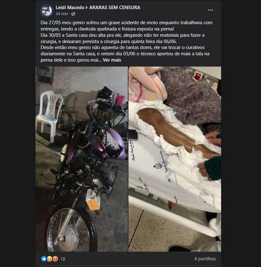 Noticias de Araras | Entregador Sofre Grave Acidente e Enfrenta Dificuldades para Tratamento Médico em Araras, SP